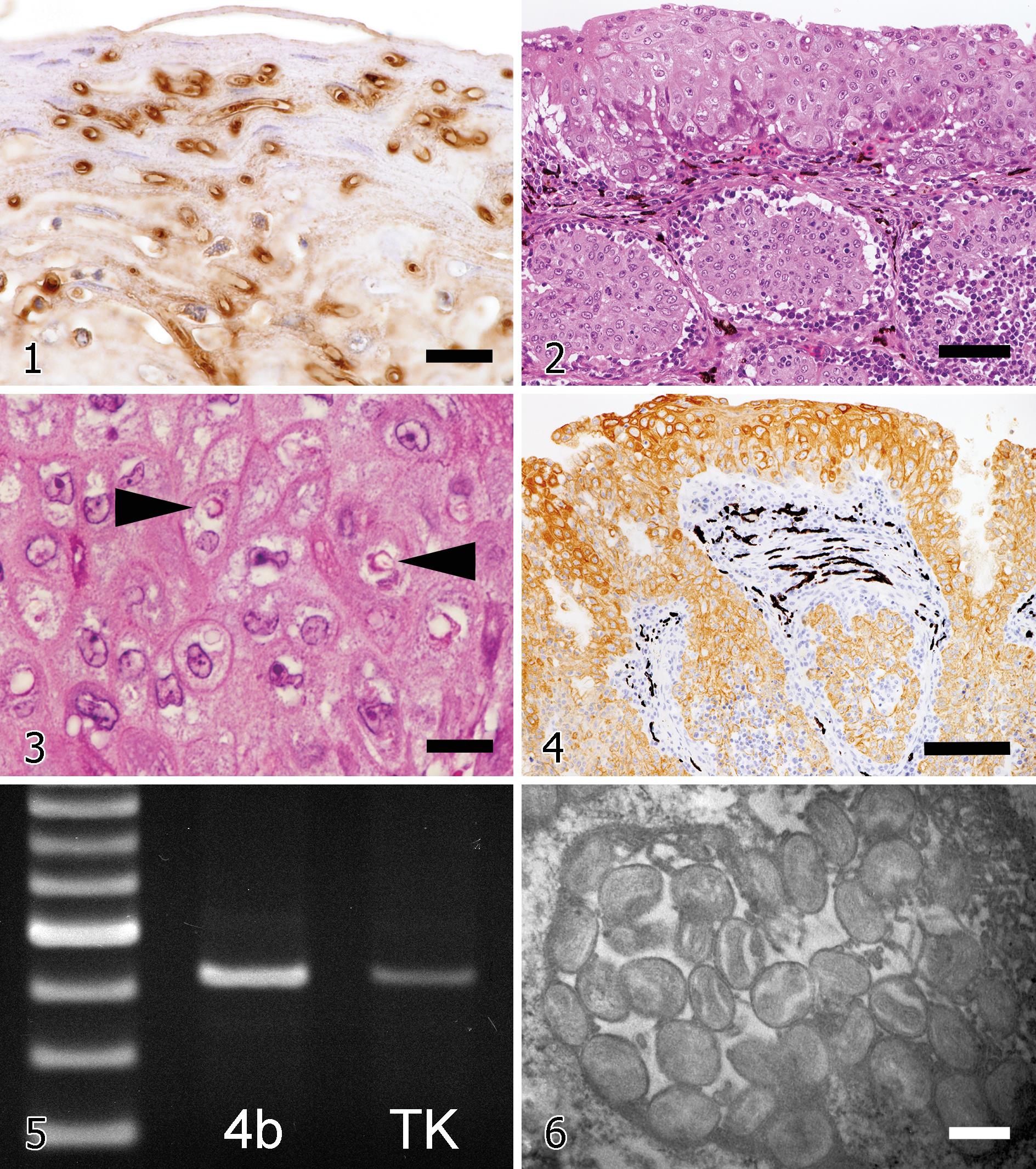 Concurrent Fowlpox And Candidiasis Diseases In Backyard Chickens With