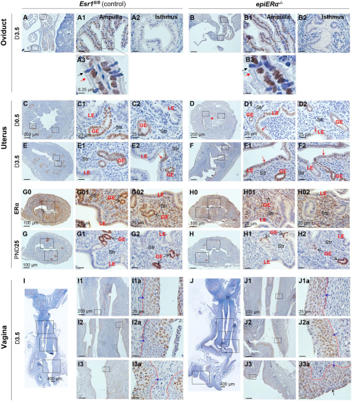 Upregulation Of Foxa In Uterine Luminal Epithelium And Vaginal Basal