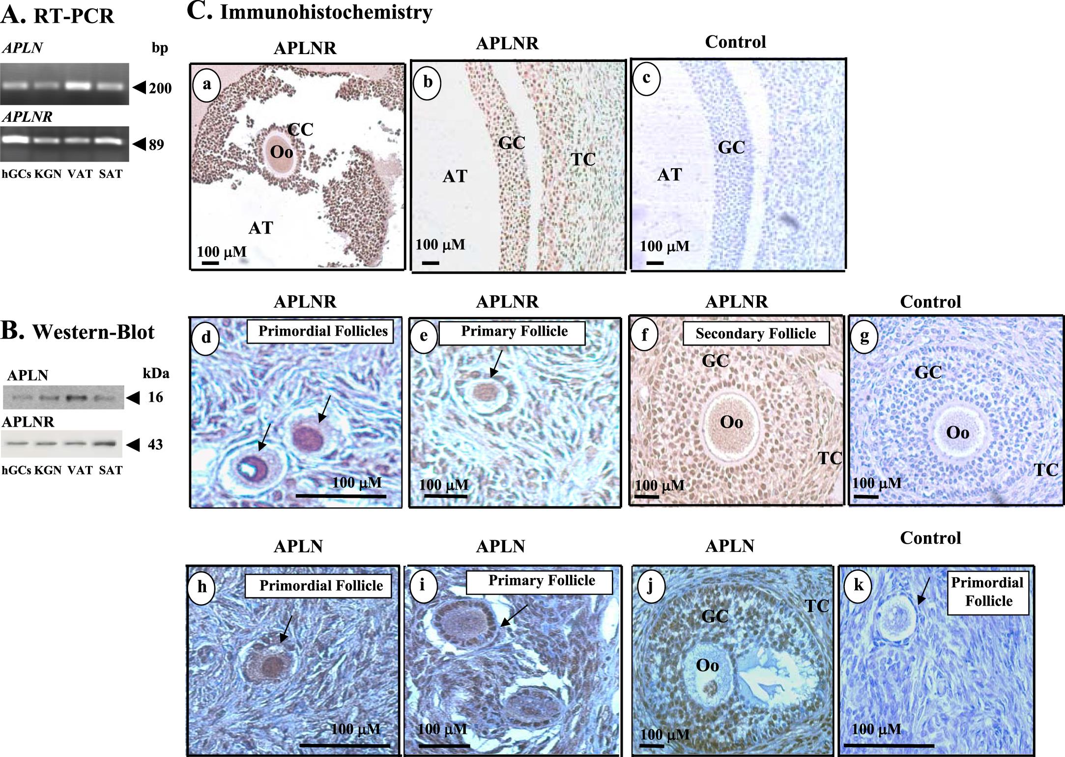 Apelin Apln And Apelin Receptor Aplnr In Human Ovary Expression