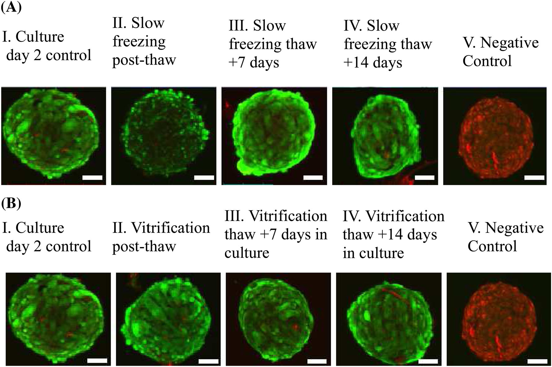 Three Dimensional Testicular Organoid A Novel Tool For The Study Of