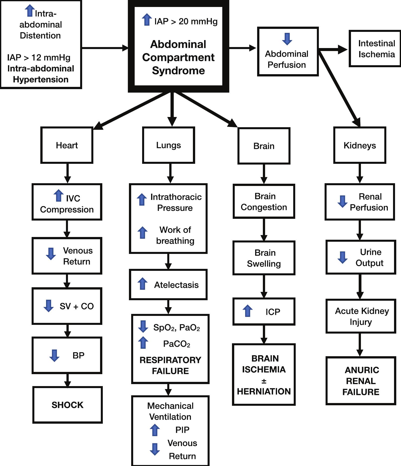 Acute Abdominal Compartment Syndrome During Colonoscopy In A Western