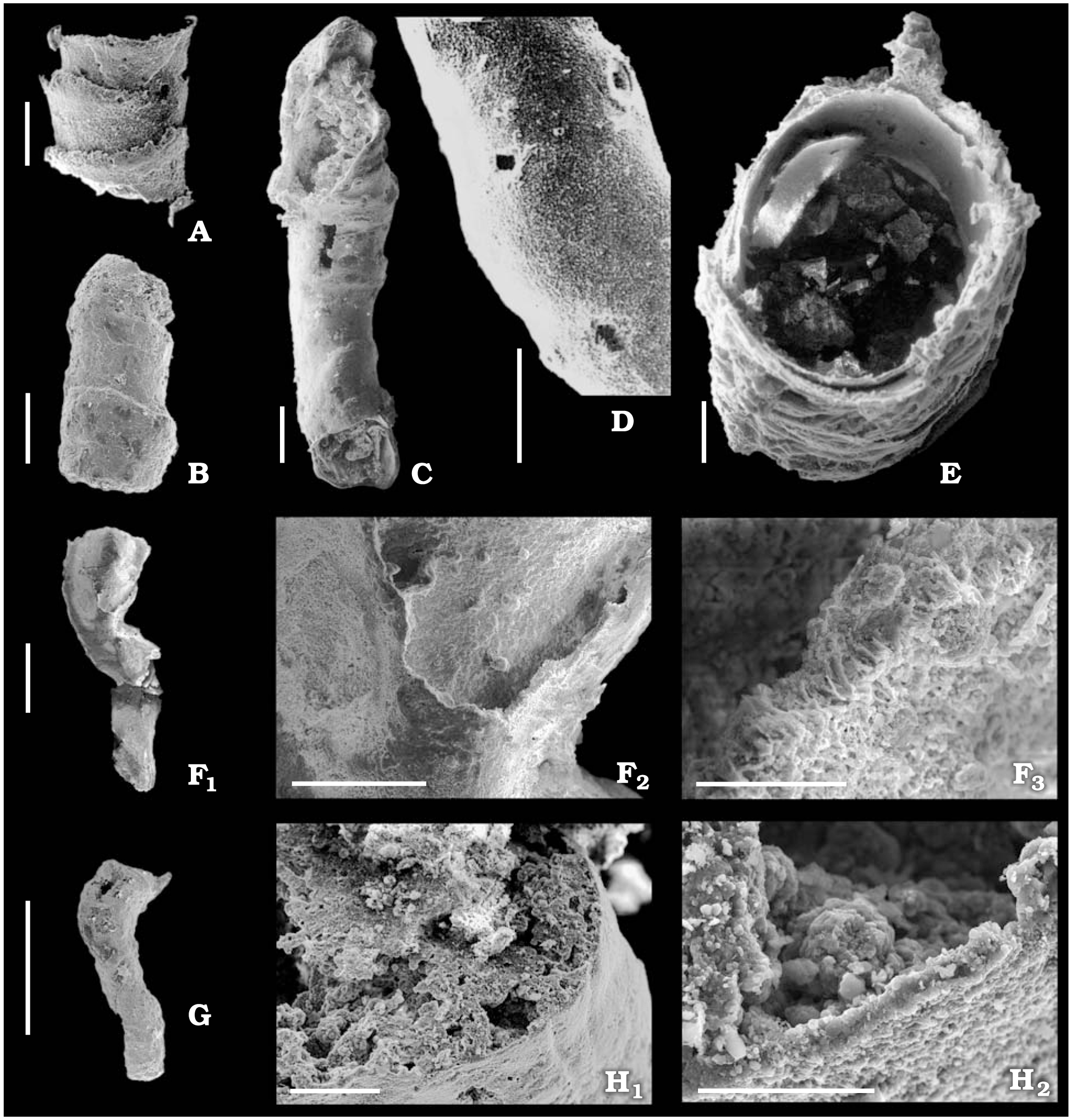 New Finds Of Skeletal Fossils In The Terminal Neoproterozoic Of The Siberian Platform And Spain