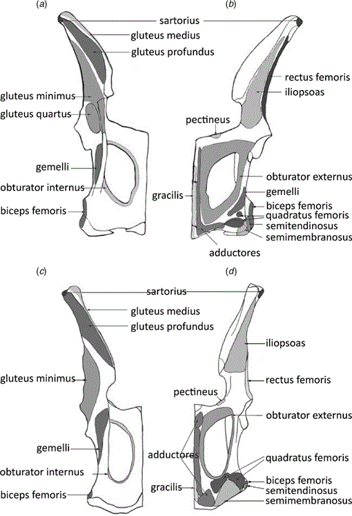 Psoas Zeichen und Obturatorzeichen