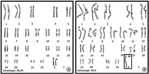 Exploring Contemporary Issues In Genetics And Society Karyotyping