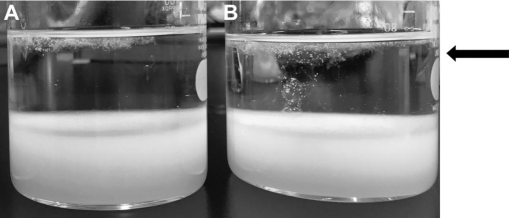 DNA Extraction: Comparing DNA Using DNase, RNase & Electrophoresis