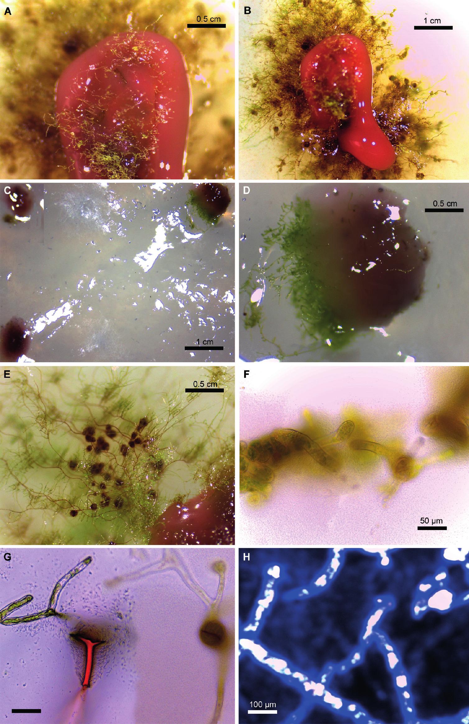 https://bioone.org/journals/annales-botanici-fennici/volume-59/issue-1/085.059.0118/Endophytic-Methylobacterium-in-Tissue-Culture-of-the-Moss-Didymodon-tectorum/10.5735/085.059.0118.full