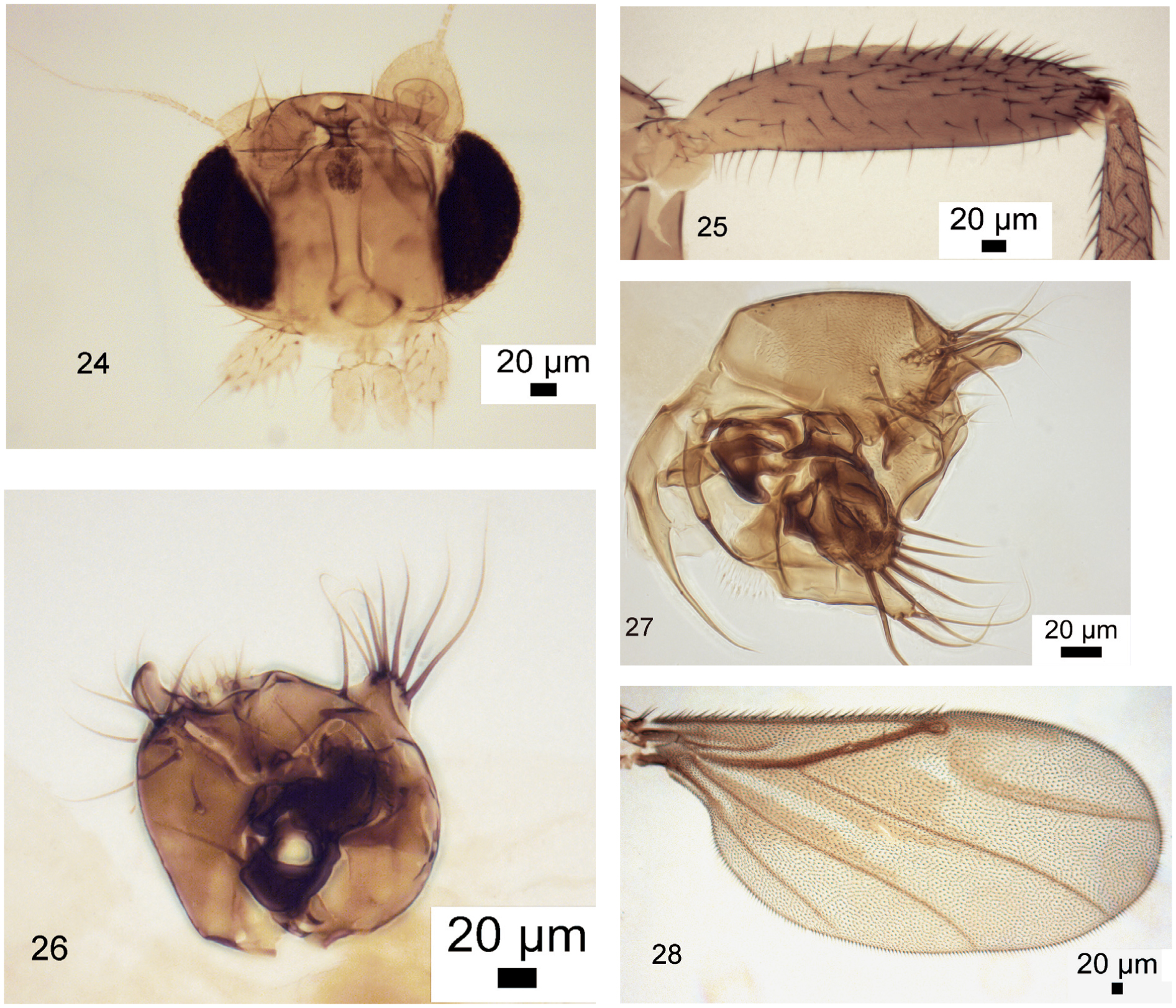 Review of Oriental Chonocephalus Wandolleck (Diptera: Phoridae)