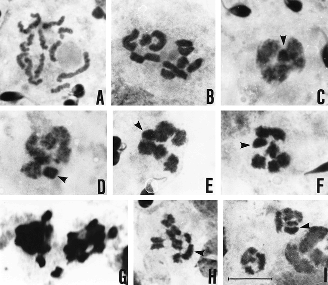 CYTOGENETIC HETEROGENEITY IN COMMON HAPLOGYNE SPIDERS FROM ARGENTINA ...
