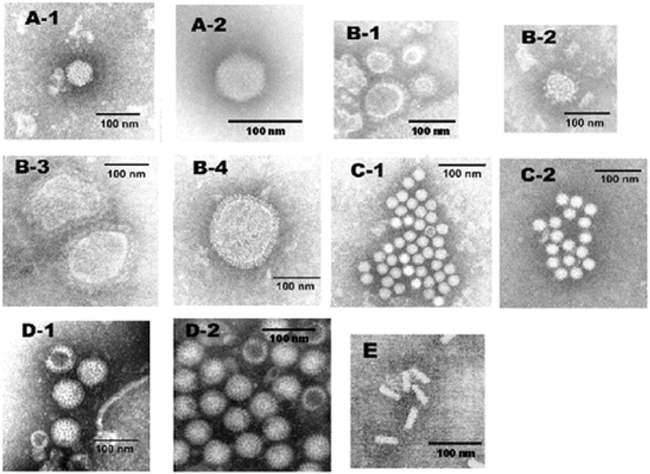 Development Of Antigen-Capture Enzyme-Linked Immunosorbent Assay And RT ...