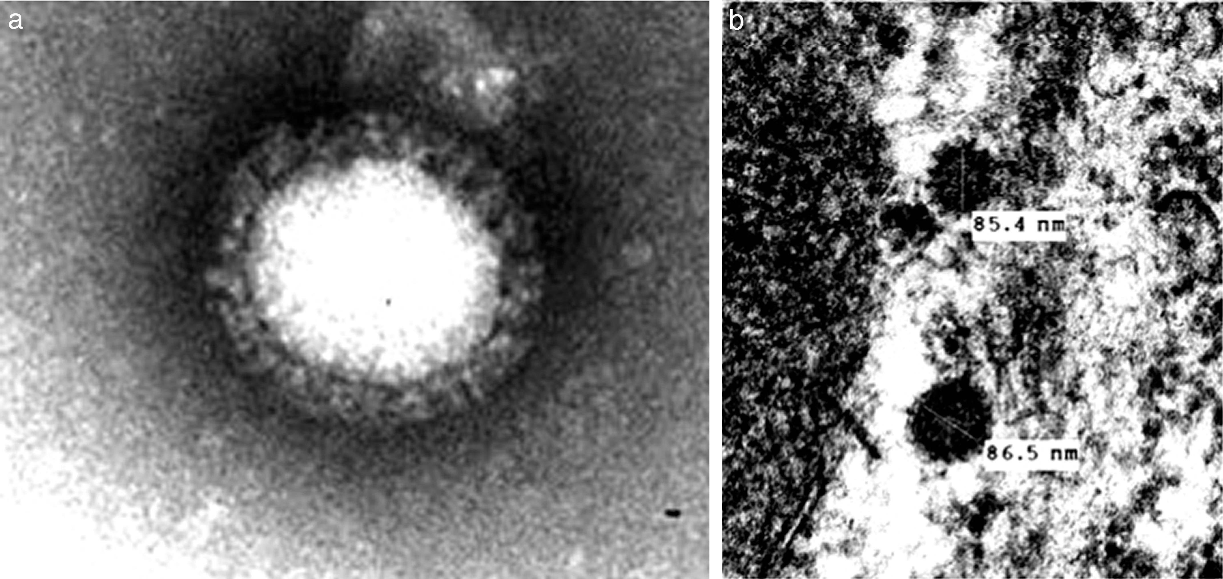 A Coronavirus Associated with Runting Stunting Syndrome in Broiler Chickens