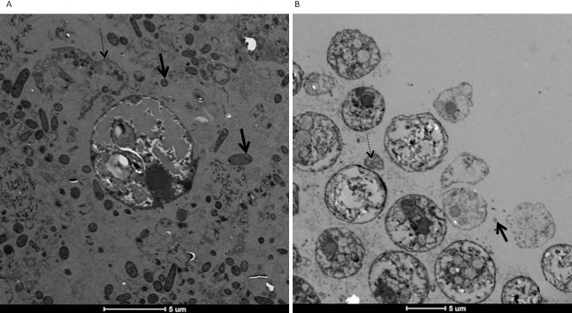 The Enrichment of Histomonas meleagridis and Its Pathogen-Specific ...