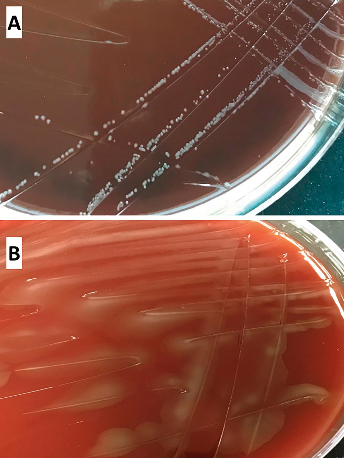 Isolation and Characterization of Campylobacter hepaticus from Layer ...