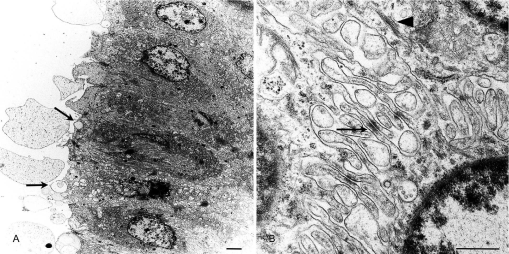 The Nasal Gland in Turkeys (Meleagris gallopavo): Anatomy, Histology ...