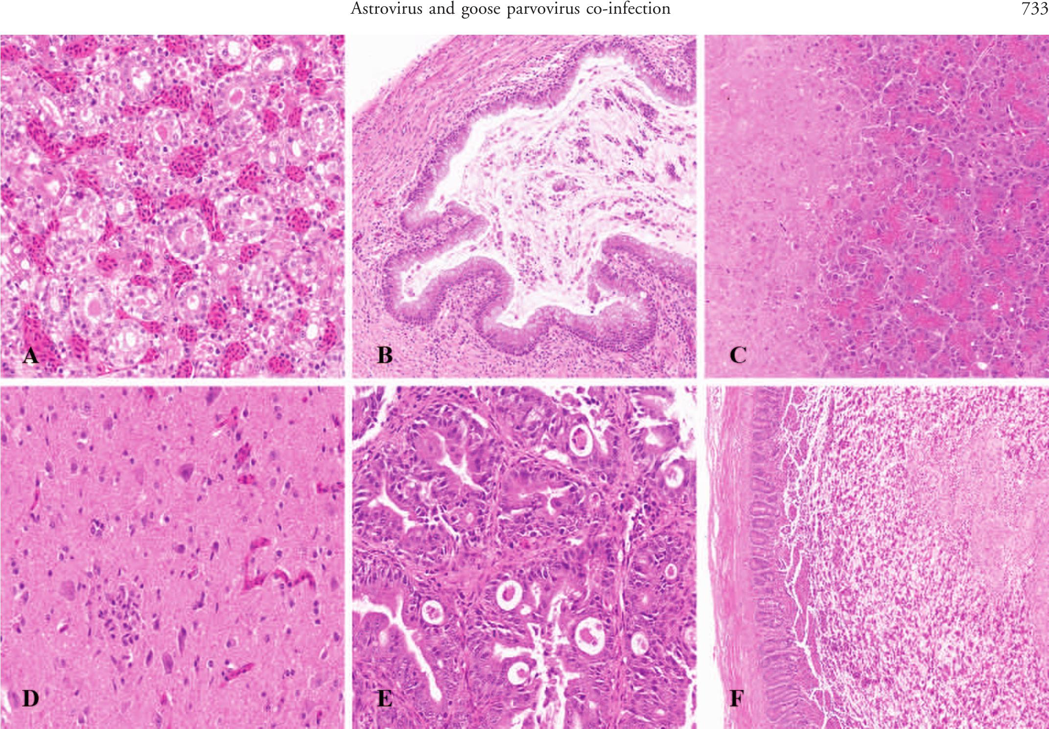 Clinical And Histologic Characterization Of Co-infection With ...