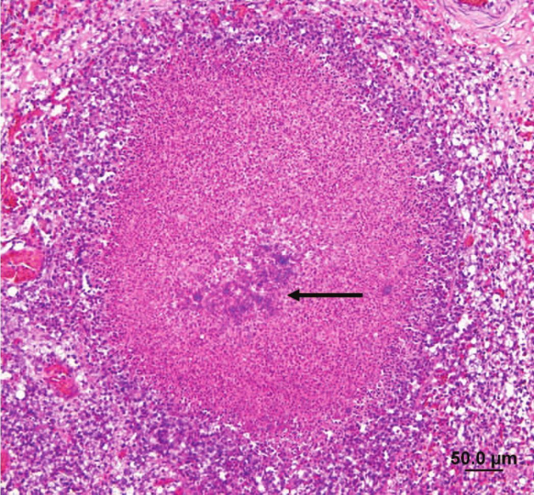 An Uncommon Case of Trueperella pyogenes Infection in an Adult Backyard ...
