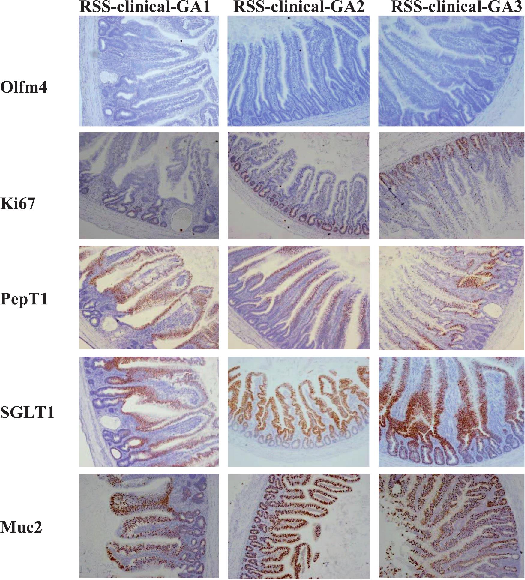 Runting Stunting Syndrome in Broiler Chickens Is Associated with ...