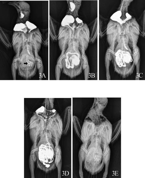 Evaluation of Gastrointestinal Tract Transit Times Using Barium ...