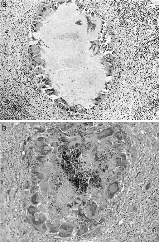 Evaluation of Multidrug Therapy With Azithromycin, Rifampin, and ...