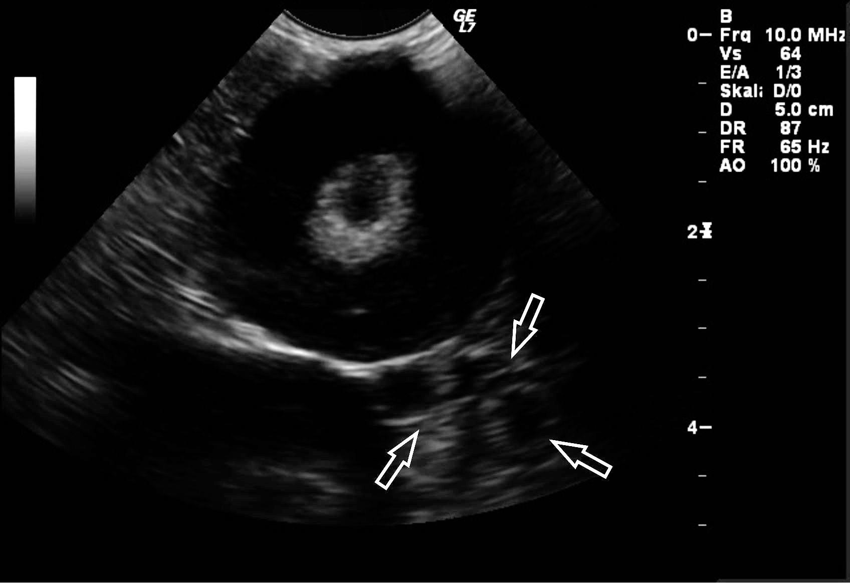 Radiography and Ultrasonography in the Backyard Poultry and Waterfowl ...