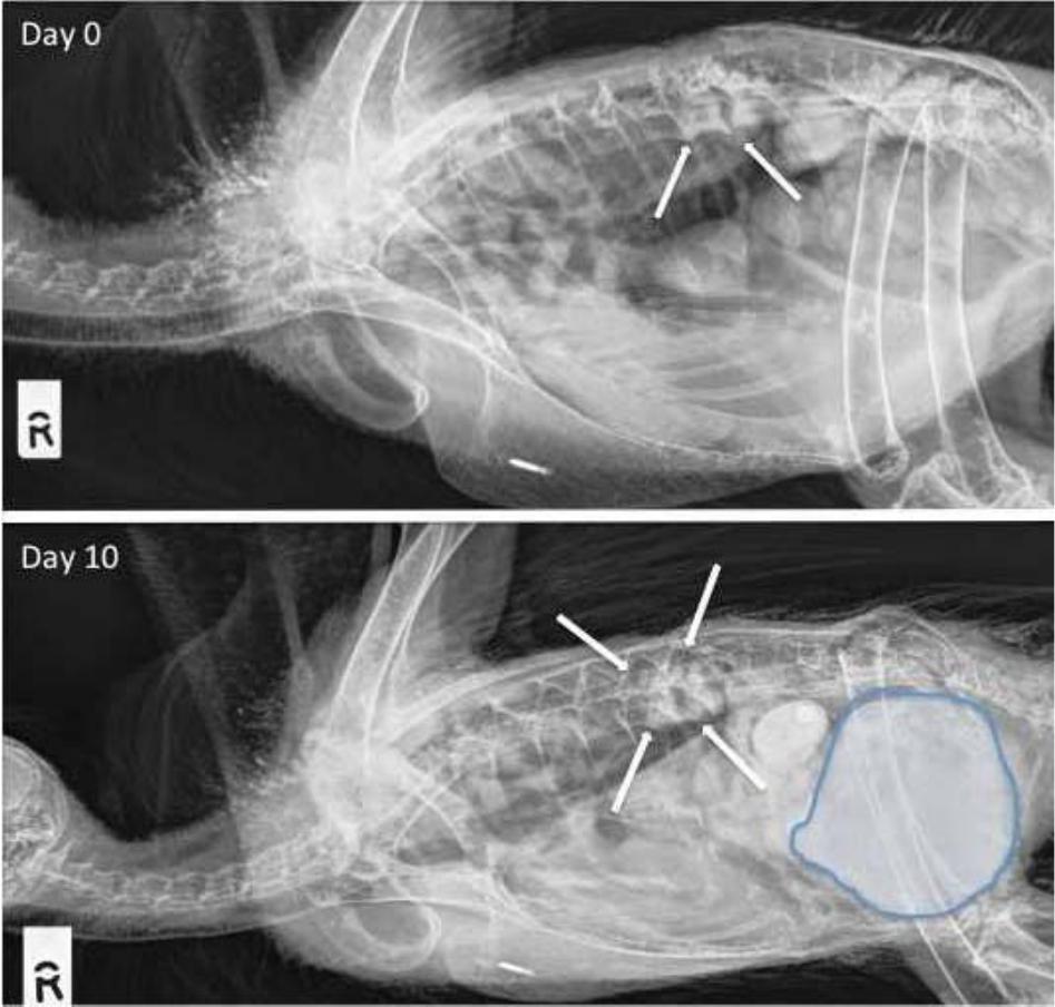 Multicentric Septic Osteomyelitis and Arthritis Caused by ...