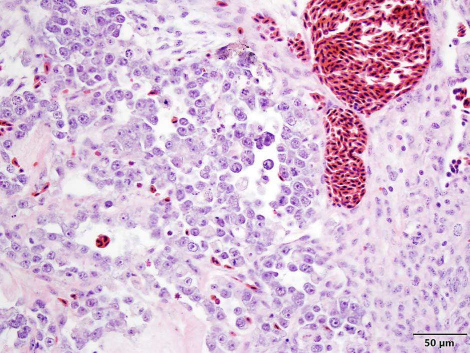 Intracoelomic Teratoma in an Eclectus Parrot (Eclectus roratus)