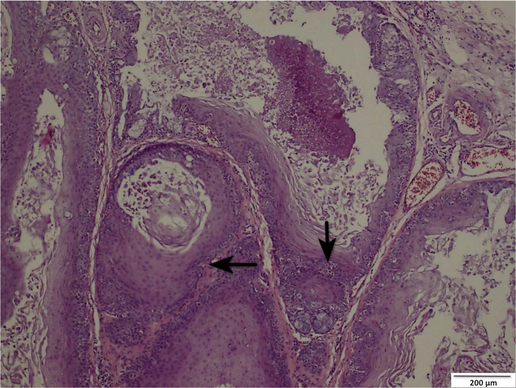 Photo inspiration: Picture Idea: Squamous Metaplasia Associated With Hypovitaminosis A Of The Crop And