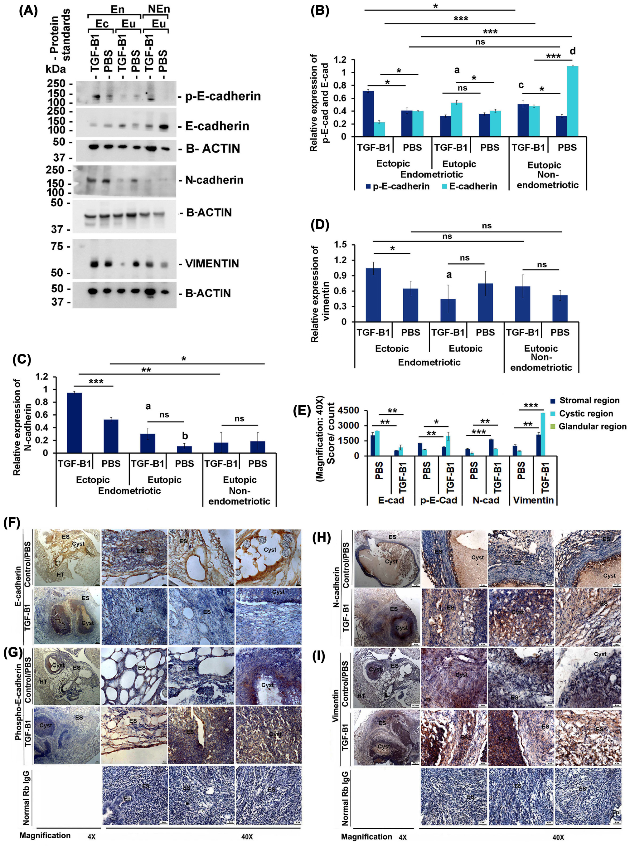 A High Level Of Tgf B1 Promotes Endometriosis Development Via Cell Migration Adhesiveness Colonization And Invasiveness