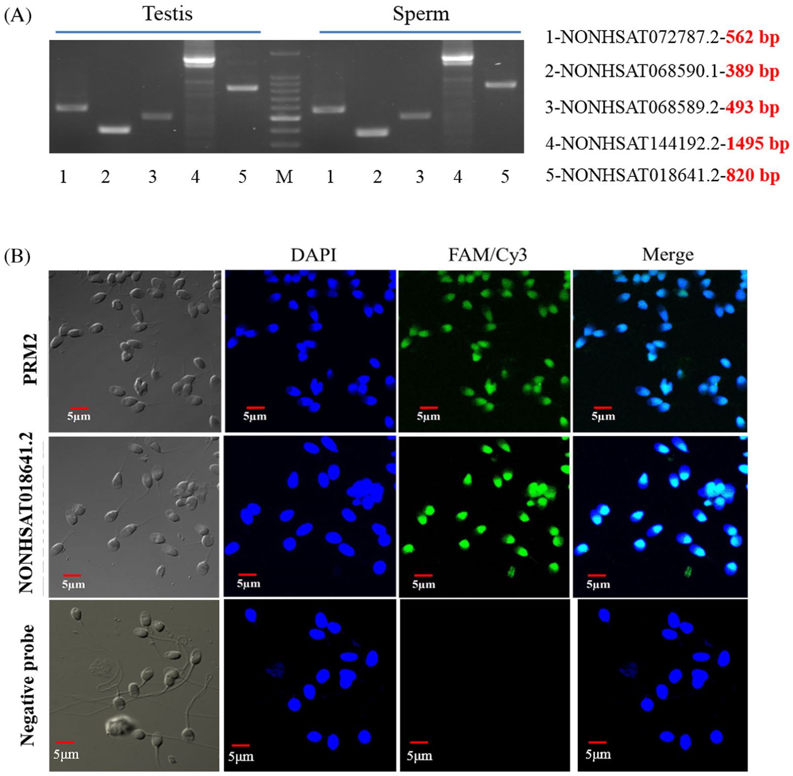 Expression Profiles And Characteristics Of Human Lncrna In Normal And Asthenozoospermia Sperm