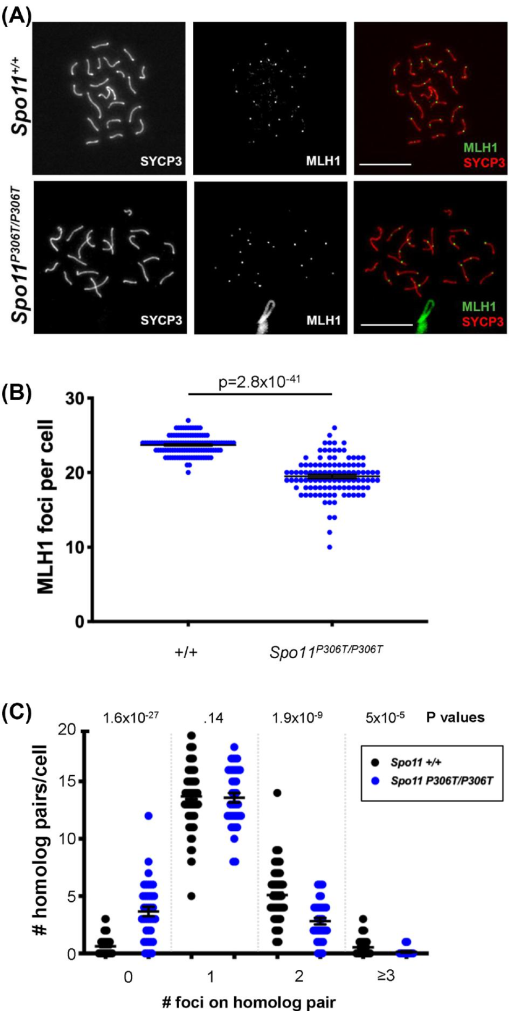 A segregating human allele of SPO11 modeled mice disrupts timing amounts of meiotic recombination, causing oligospermia and a decreased ovarian
