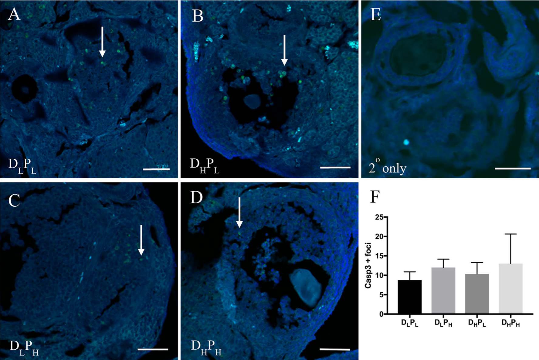 Developmental Origins Of Ovarian Disorder Impact Of Maternal Lean Gestational Diabetes On The Offspring Ovarian Proteome In Mice