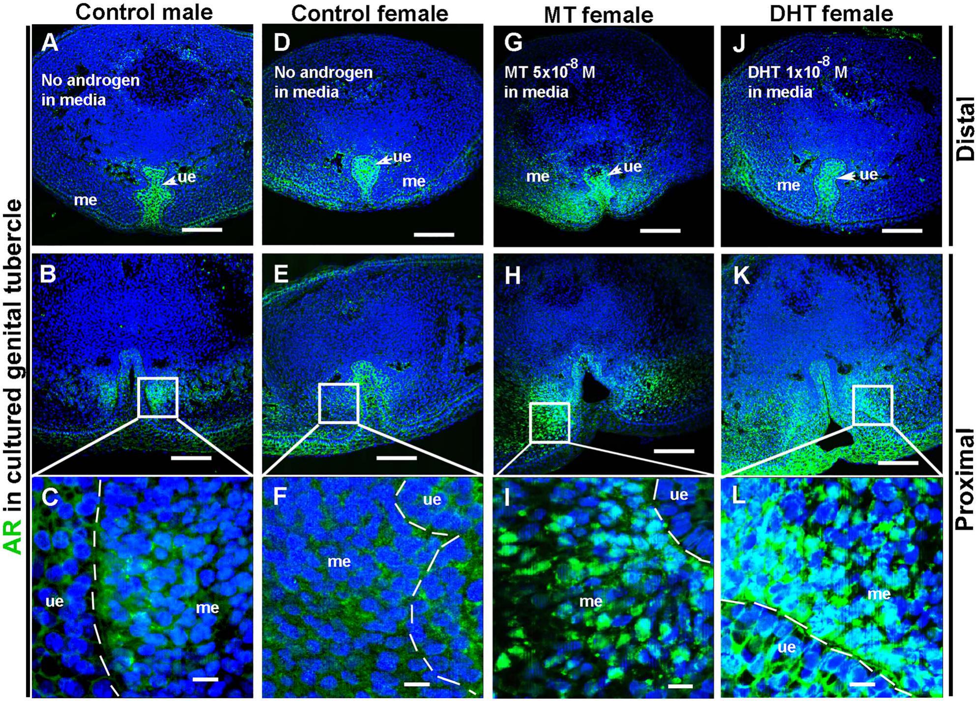 Prenatal Low Dose Methyltestosterone But Not Dihydrotestosterone Treatment Induces Penile Formation In Female Mice And Guinea Pigs