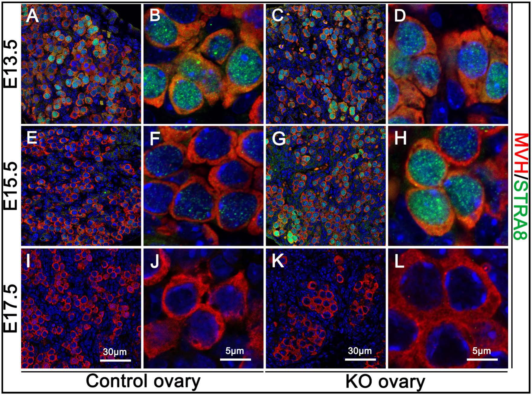 Inactivation of Wt1 causes pre-granulosa cell to steroidogenic cell ...