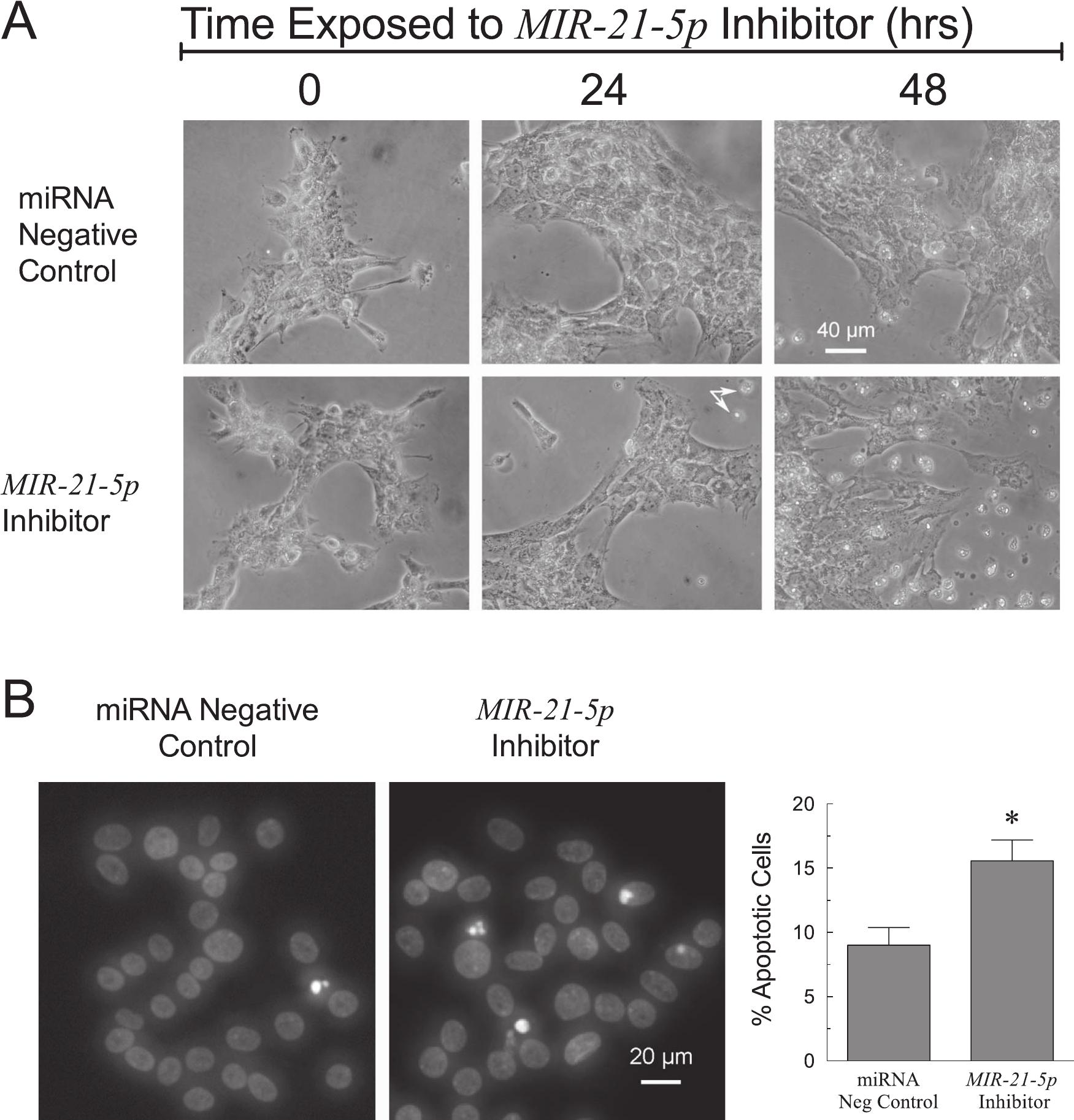 MicroRNA-21 as a regulator of human cumulus cell viability and its