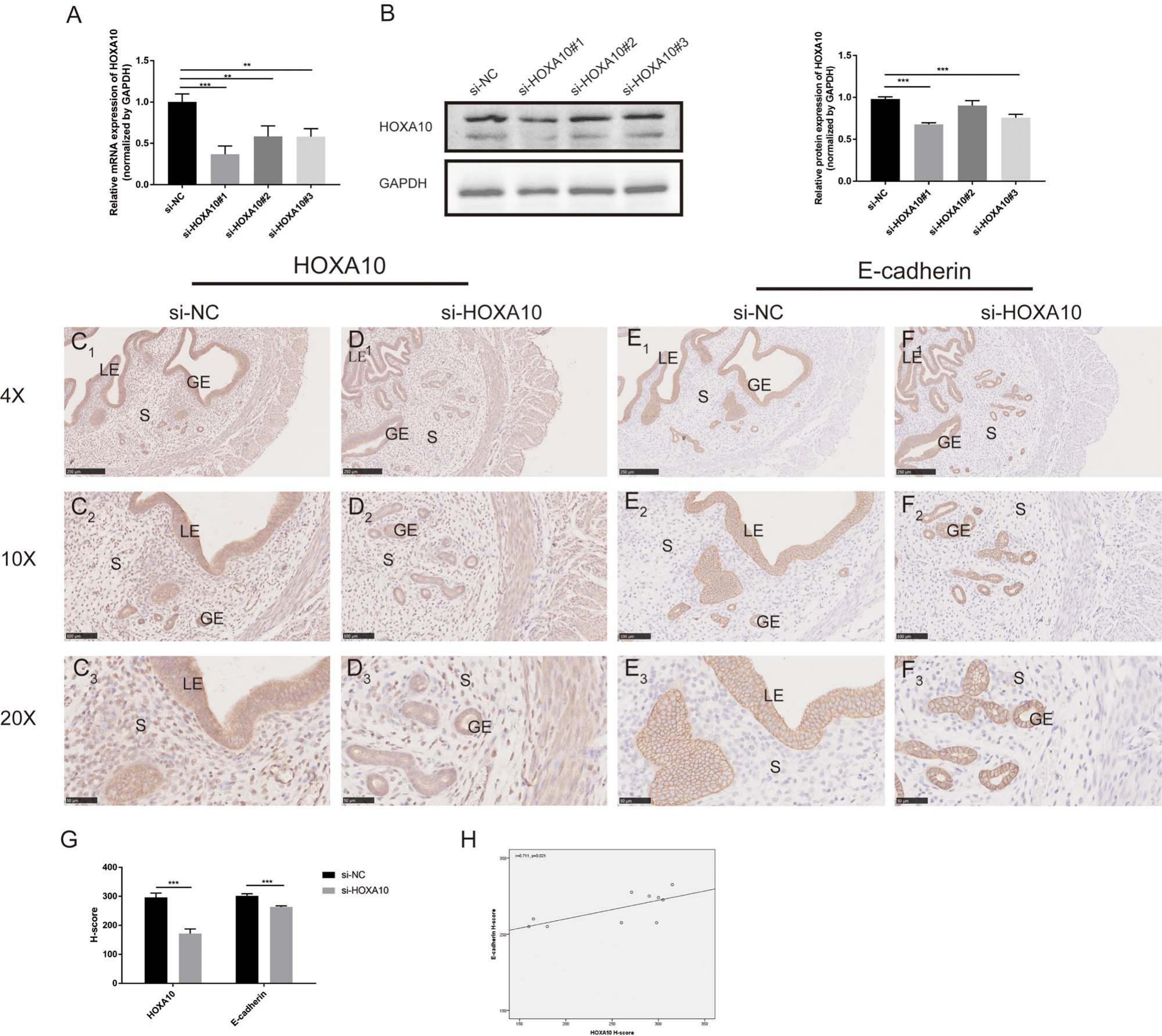 Hoxa10 Improves Endometrial Receptivity By Upregulating E-cadherin†