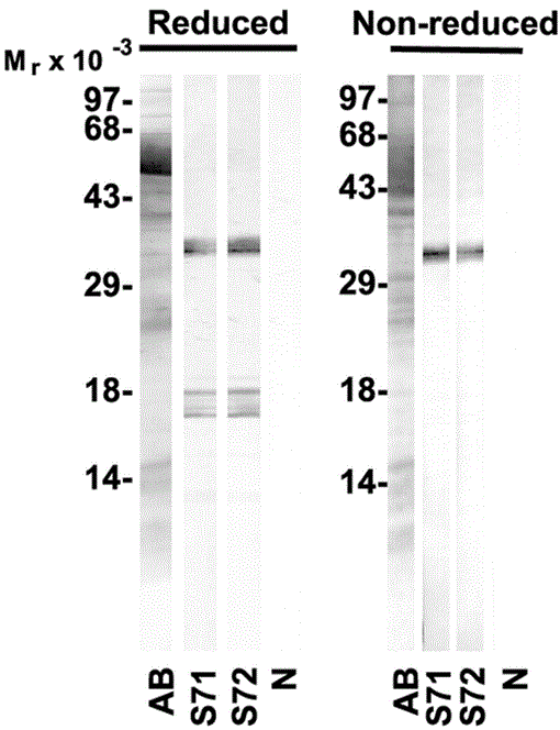 Results of FISH analysis of human male metaphase chromosomes with a