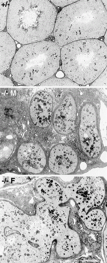 Desert hedgehog (Dhh) Gene Is Required in the Mouse Testis for