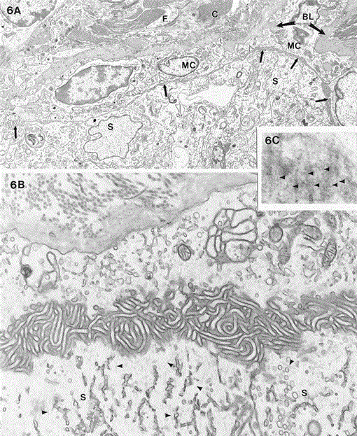Desert hedgehog (Dhh) Gene Is Required in the Mouse Testis for
