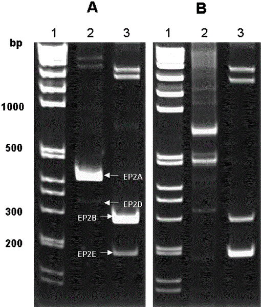 EP2 Splicing Variants in Rhesus Monkey (Macaca mulatta) Epididymis1