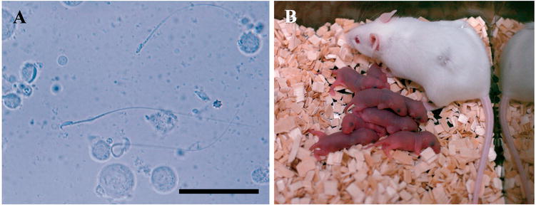 Generation of Normal Progeny by Intracytoplasmic Sperm Injection Following  Grafting of Testicular Tissue from Cloned Mice That Died Postnatally1