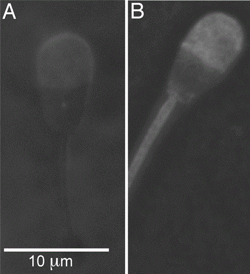 Visualization Of Gm1 With Cholera Toxin B In Live Epididymal Versus Ejaculated Bull Mouse And Human Spermatozoa1