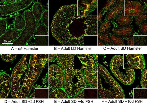 Adult Sertoli Cells Are Not Terminally Differentiated in the 