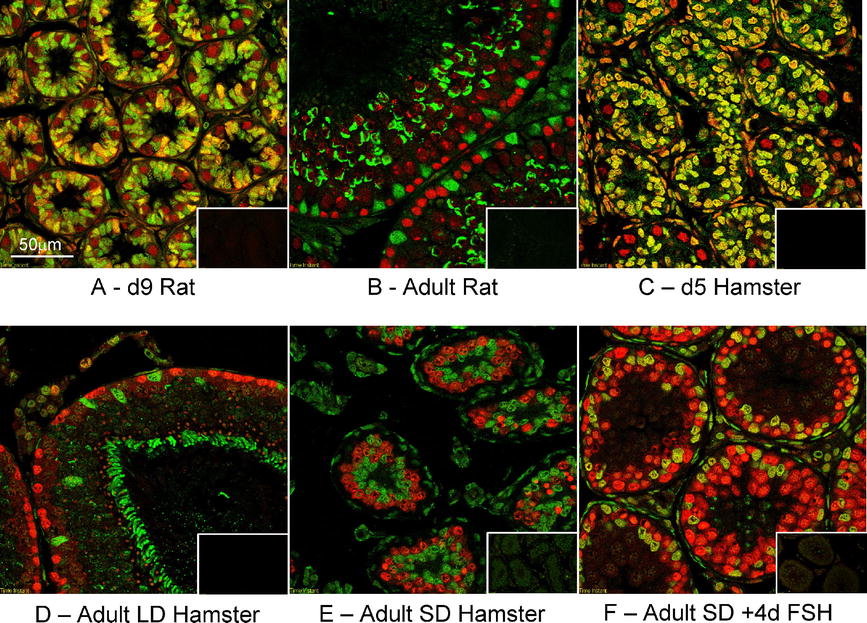 Adult Sertoli Cells Are Not Terminally Differentiated in the 