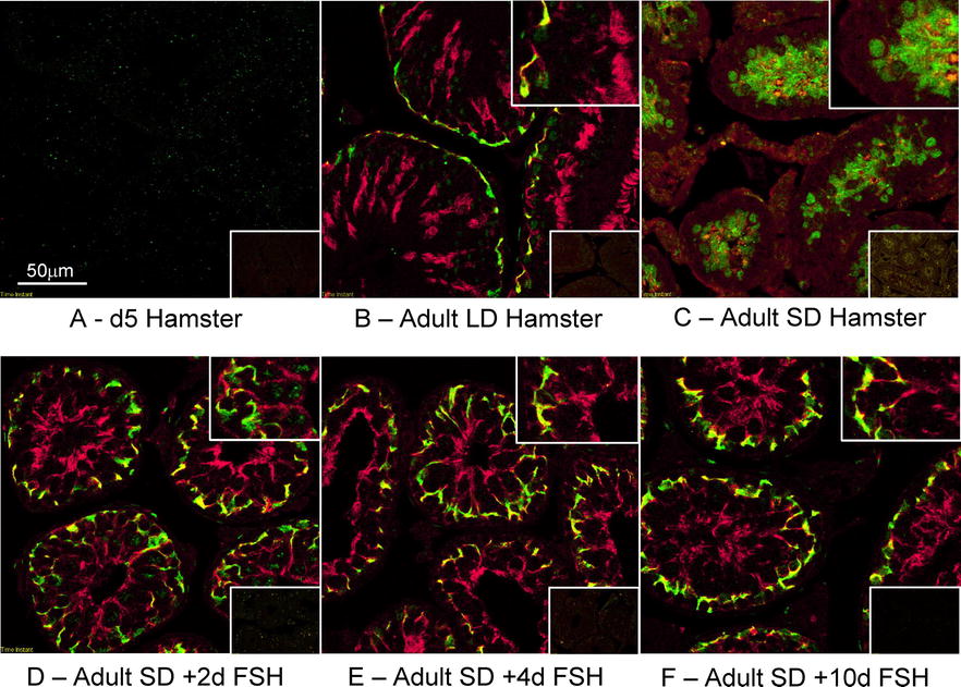 Adult Sertoli Cells Are Not Terminally Differentiated in the 