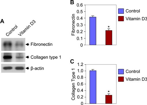 125 Dihydroxyvitamin D3 Treatment Shrinks Uterine Leiomyoma