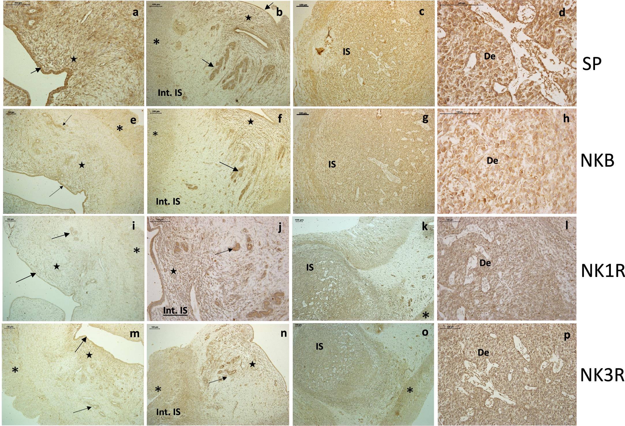 Analysis Of The Expression Of Tachykinins And Tachykinin Receptors In The Rat Uterus During Early Pregnancy1