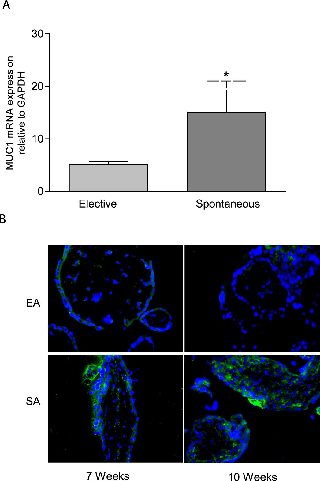 Adrenomedullin 2 (ADM2) Regulates Mucin 1 at the Maternal-Fetal ...