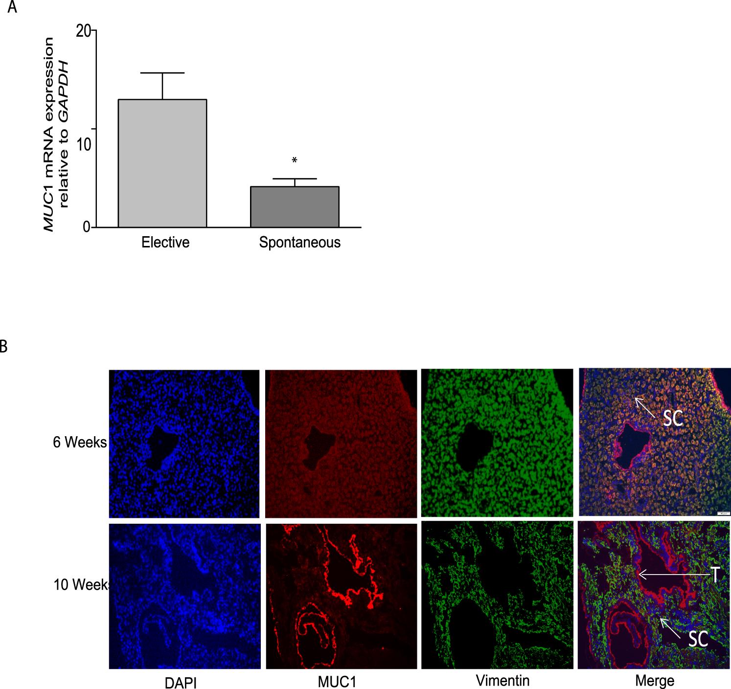 Adrenomedullin 2 (ADM2) Regulates Mucin 1 at the Maternal-Fetal ...