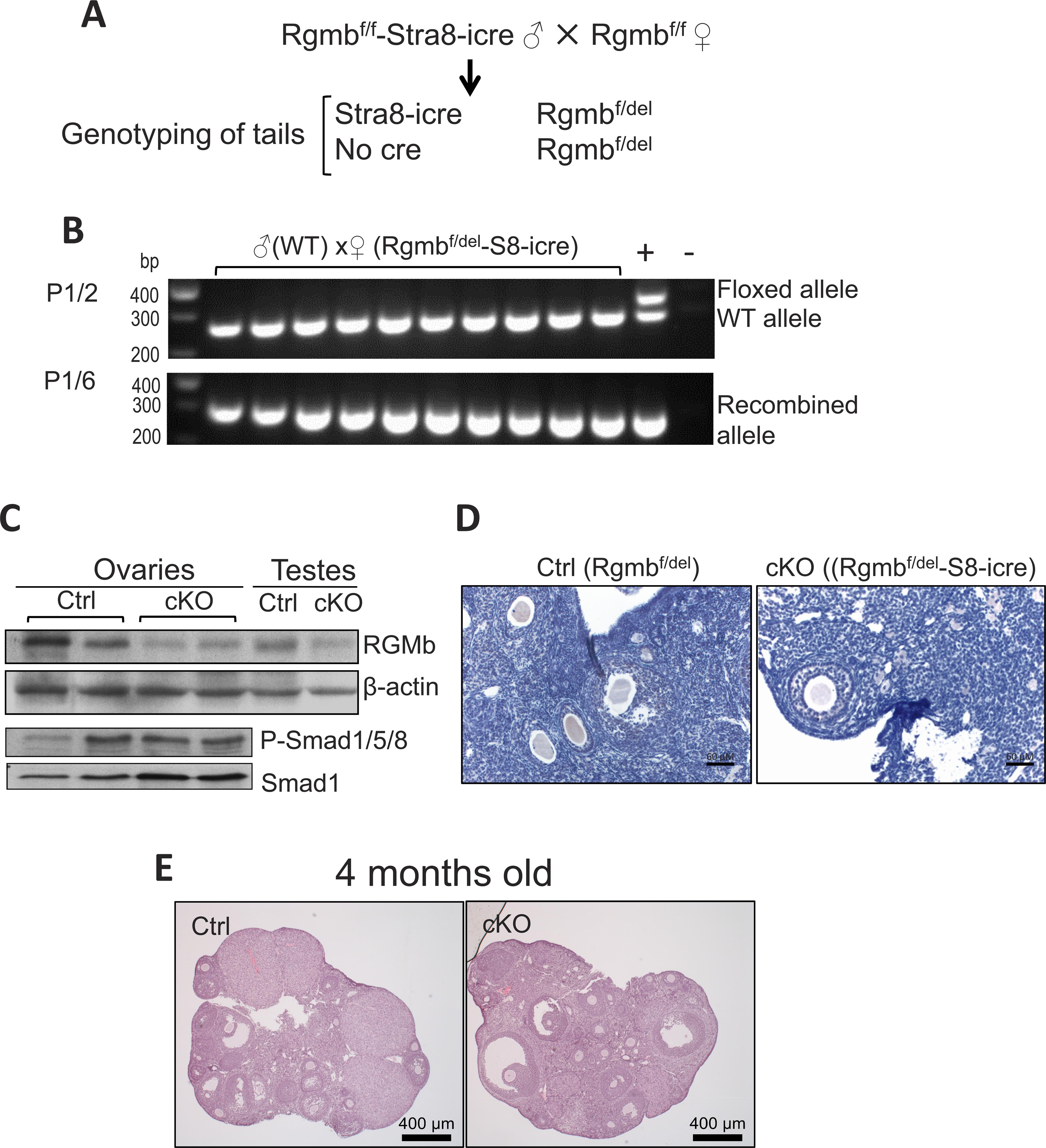 Repulsive Guidance Molecule B (RGMb) Is Dispensable For Normal Gonadal ...