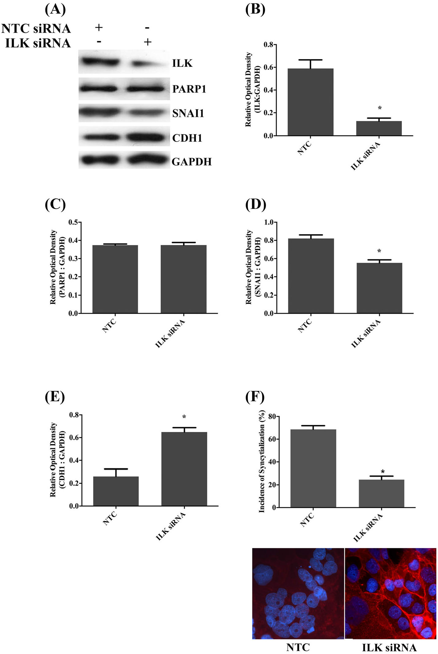 Integrin Linked Kinase Regulates Syncytialization Of Bewo Trophoblast Cells