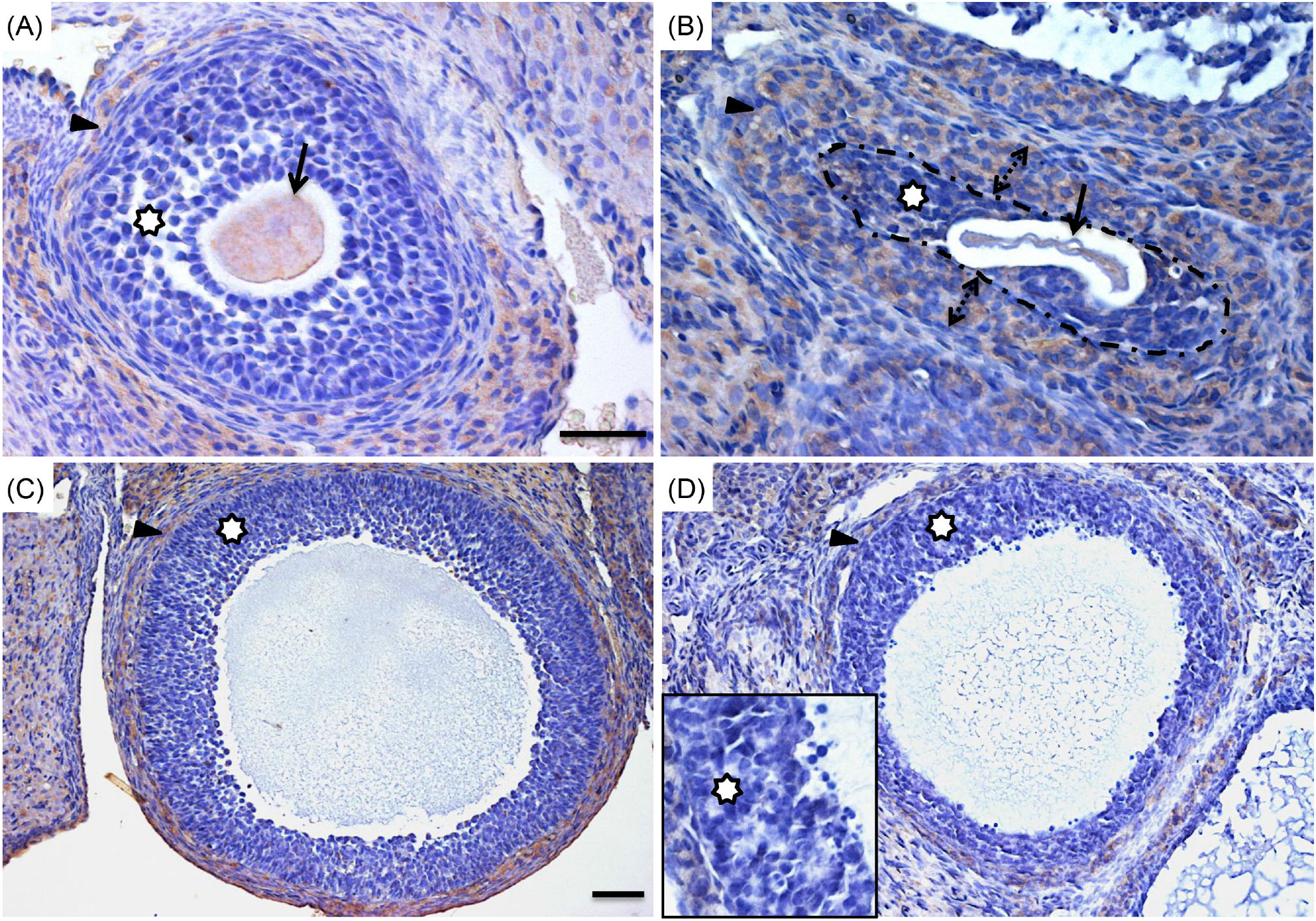 Preantral Follicular Atresia Occurs Mainly Through Autophagy While Antral Follicles Degenerate